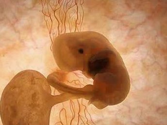 死精率80%的男性可以在广水市做三代试管吗？公开2026做三代试管条件