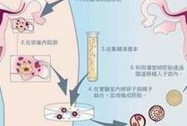 父母双方都患有地中海贫血还能做试管婴儿生小孩吗？
