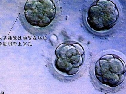 如何提高试管婴儿的成功率？试管几次可以成功？